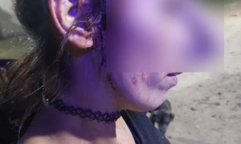 Violencia de Género: Un hombre atacó por segunda vez a su ex pareja